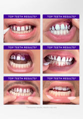 V34 Whitening Strips